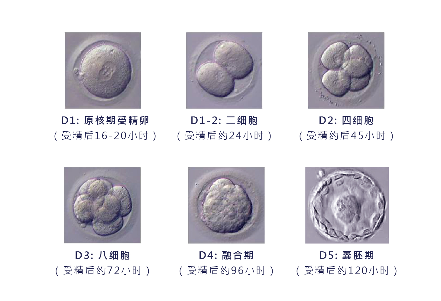 囊胚培养的优势与移植颗数的迷思