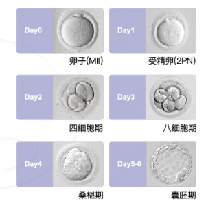 移植第三天胚胎与第五天囊胚有何差异